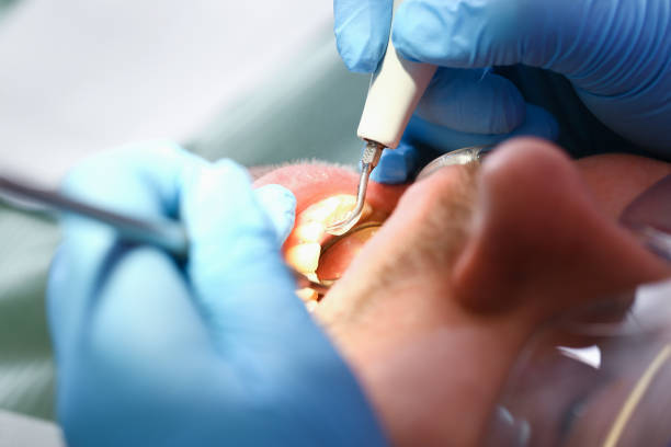 Best Emergency Dental Care for Broken or Chipped Teeth in Cascade Locks, OR